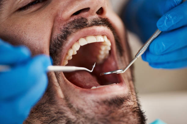 Best Emergency Dental Services for Seniors in South San Gabriel, CA